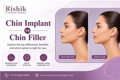 Chin Implant vs Chin Filler Which One Is Better for You